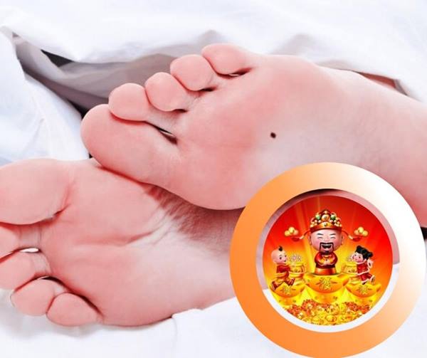 Nốt ruồi may mắn Nốt ruồi may mắn